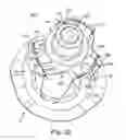 Fig. 17 - Prosthetic heart valve system
