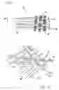 Fig. 02 - Woven implantable device