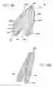 Fig. 04 - Woven implantable device