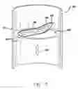 Fig. 06 - Woven implantable device