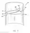 Fig. 07 - Valve device with inflatable chamber