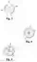 Fig. 03 - Corneal implants and methods of use