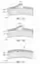 Fig. 19 - Corneal optic formed of degradation resistant polymer