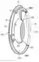 Fig. 01 - Capsular tension ring, method for making a capsular tension ring and capsular ring and intraocular lens assembly