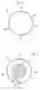 Fig. 04 - Capsular tension ring, method for making a capsular tension ring and capsular ring and intraocular lens assembly