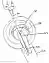 Fig. 01 - Surgical methods for anchoring and implanting tissues