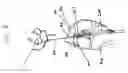 Fig. 04 - Surgical methods for anchoring and implanting tissues