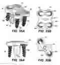 Fig. 31 - Flanged interbody fusion device with fastener insert and retaining ring