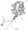 Fig. 02 - Spinal implant apparatus, method and system