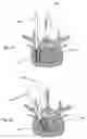 Fig. 09 - Spinal implant apparatus, method and system