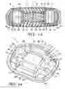 Fig. 04 - Intervertebral prosthesis