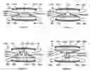 Fig. 08 - Intervertebral implant having features for controlling angulation thereof