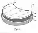 Fig. 03 - Artificial prosthesis
