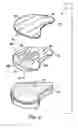 Fig. 04 - Artificial prosthesis