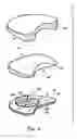 Fig. 05 - Artificial prosthesis