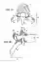 Fig. 03 - Flanged interbody fusion device with hinge