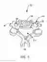 Fig. 04 - Flanged interbody fusion device with hinge
