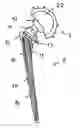 Fig. 01 - Joint prosthesis made from a titanium alloy