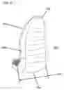 Fig. 04 - Unicondylar knee implant