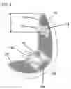 Fig. 05 - Unicondylar knee implant