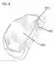 Fig. 09 - Unicondylar knee implant
