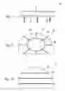 Fig. 04 - Flexible segmented bearing implant