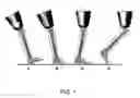 Fig. 02 - Device and system for prosthetic knees and ankles