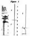 Fig. 04 - Well Pump Controller Unit