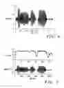 Fig. 05 - Bandwidth efficient digital voice communication system and method