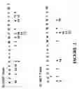 Fig. 03 - Identifying patterns of symbols in sequences of symbols using a binary array representation of the sequence