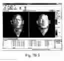 Fig. 08 - Mask fitting system and method