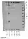 Fig. 17 - Nucleic acid molecules encoding starch degrading enzymes