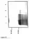 Fig. 19 - Nucleic acid molecules encoding starch degrading enzymes