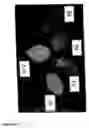 Fig. 20 - Nucleic acid molecules encoding starch degrading enzymes