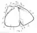 Fig. 04 - Sleeper bag garment