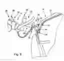 Fig. 05 - Mehtod for cleaning a component and appropriate cleaning device