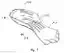 Fig. 07 - Orthotic with dynamically self-adjusting stabiliser for footwear