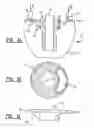 Fig. 03 - Device and method for dislodging and recovering dredging material of varying nature
