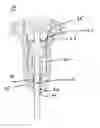 Fig. 01 - Lockable torque-limiting driver and method