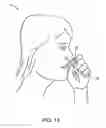 Fig. 11 - Methods for treating headaches