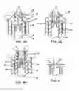 Fig. 04 - Methods for treating trigeminal neuralgia