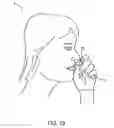 Fig. 11 - Methods for treating trigeminal neuralgia