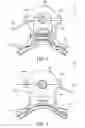 Fig. 07 - CPAP mask and system
