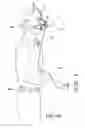 Fig. 10 - CPAP mask and system