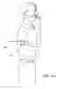 Fig. 13 - CPAP mask and system