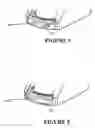 Fig. 04 - Breathing assistance apparatus