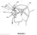 Fig. 03 - Breathing assistance apparatus
