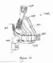 Fig. 12 - Breathing assistance apparatus