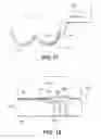 Fig. 16 - Hat for treating a tumor or the like