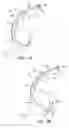 Fig. 02 - Transgastric abdominal access